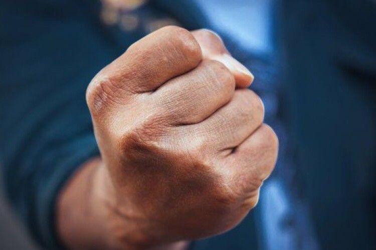 Чоловік побив зоозахисника, який хотів відчепити від дерева пса
