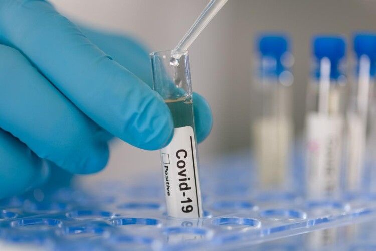 Україна додатково закупить 1,2 мільйона ПЛР-тестів для діагностики коронавірусу