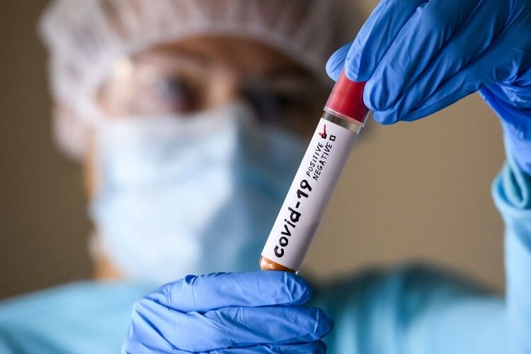 На Львівщині виявлено новий штам коронавірусу 