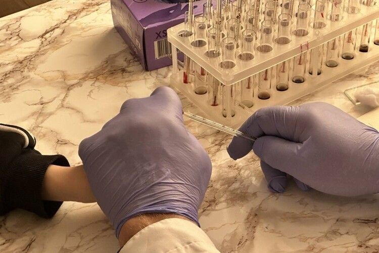 Перевірка на ВІЛ, гепатити та ЕКГ без черг: у селі на Волині медики влаштували день здоров'я