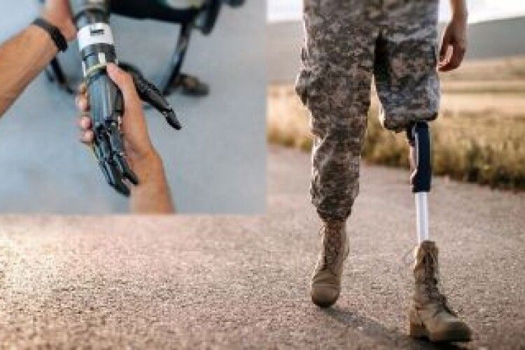 Ковельське МТМО допомагає військовим, яким ампутували кінцівки, з протезуванням
