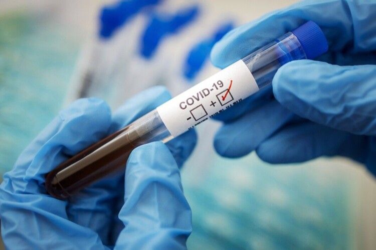 За тиждень на Волині від коронавірусу померло двоє людей