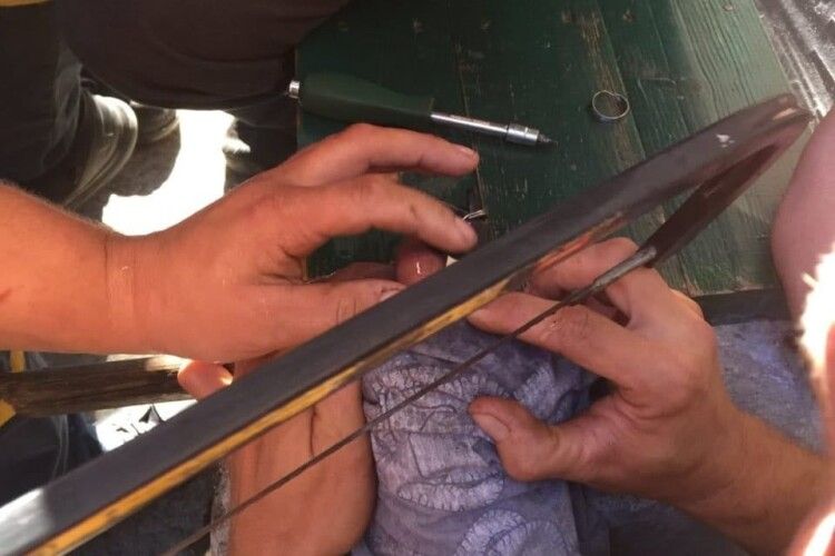 Бійцям ДСНС довелося ножівкою розпилювати каблучку на пальці 15-річного парубка (Фото)