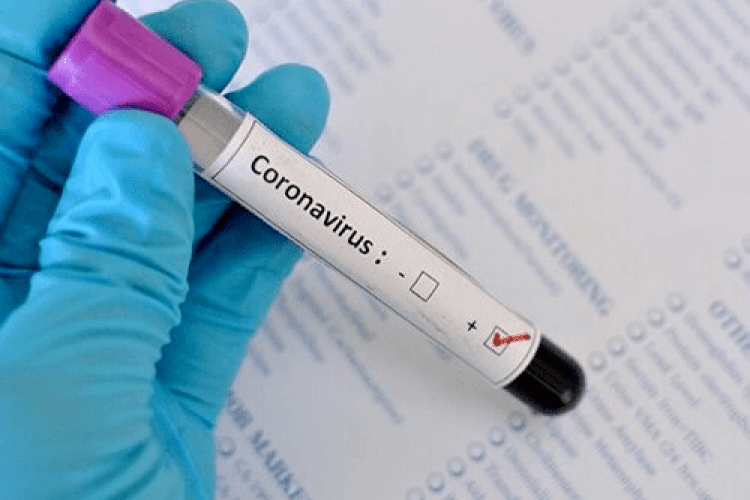 У Володимирі кров для лікування хворих на коронавірус збиратимуть в тих, хто одужав від нього