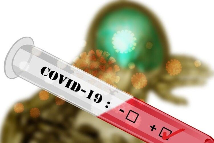 Антитіла до коронавірусу можуть бути навіть у людей, які ним не хворіли