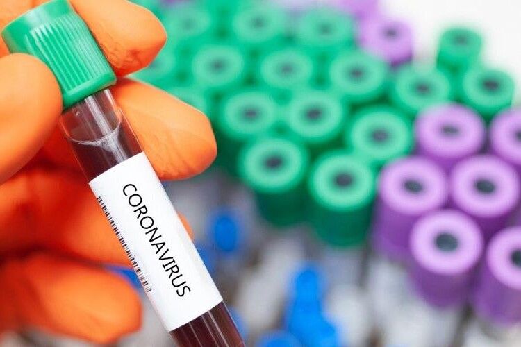 На Волині за добу на коронавірус захворіло 328 людей, в Україні 13 825 нових інфікованих