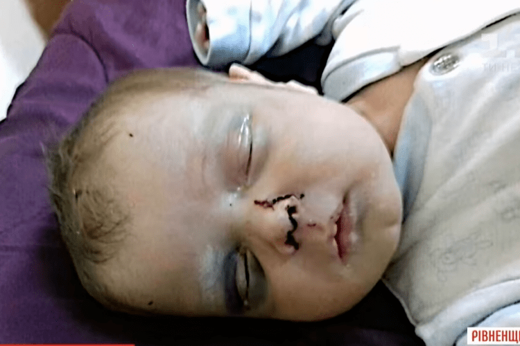 Немовля не могло дихати через кров у носі: мати покинула травмовану дитину і пішла на побачення (Відео)