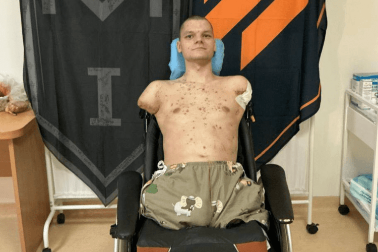 ПриватБанк покриє витрати на протезування ветерана після гучного скандалу в мережі (Відео)