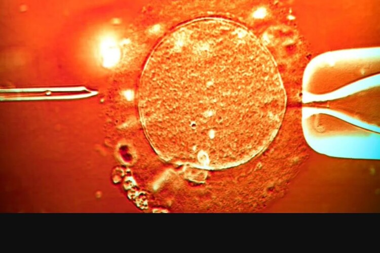 Донор сперми з мутацією, яка викликає рак, став батьком щонайменше 197 дітей