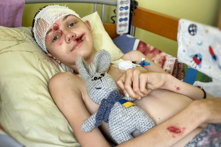 Поки спав, прилетіла ракета: у Львові провели складну операцію на черепі хлопчику з Харківщини