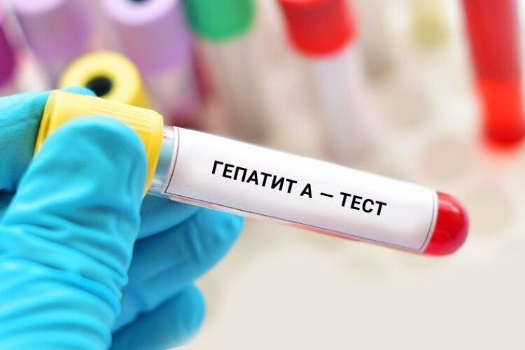 На Волині зафіксували спалах вірусного гепатиту A 