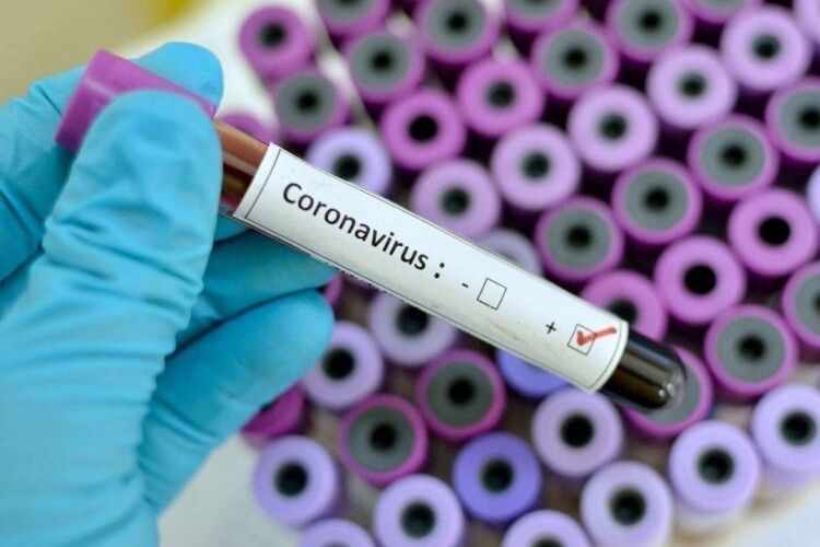 В Україні 41 випадок захворювання на коронавірус (Оновлено)