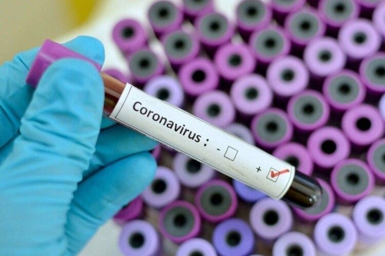 В Україні 10 нових випадків COVID-19. На Волині позитивні тести на коронавірус у двох людей