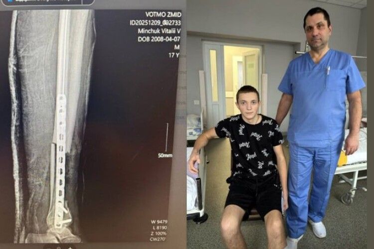 У Луцьку медики «приживили» ногу 16-річному хлопцю після жахливої аварії