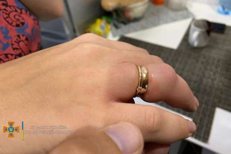 Як четверо надзвичайників рятували жінку від обручки (фото)