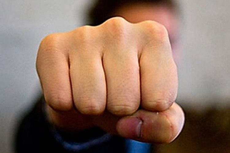 На Волині зламали щелепу за те, що сказав … добре слово
