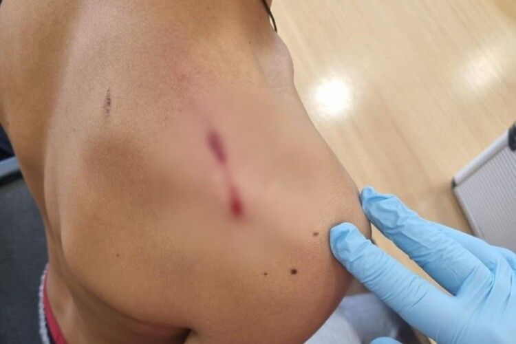 На Закарпатті учень вистрілив в однокласника під час уроку