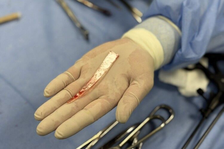 Вийшов на балкон подивитися на «шахед»: у Львові чоловік ледь не загинув через цікавість