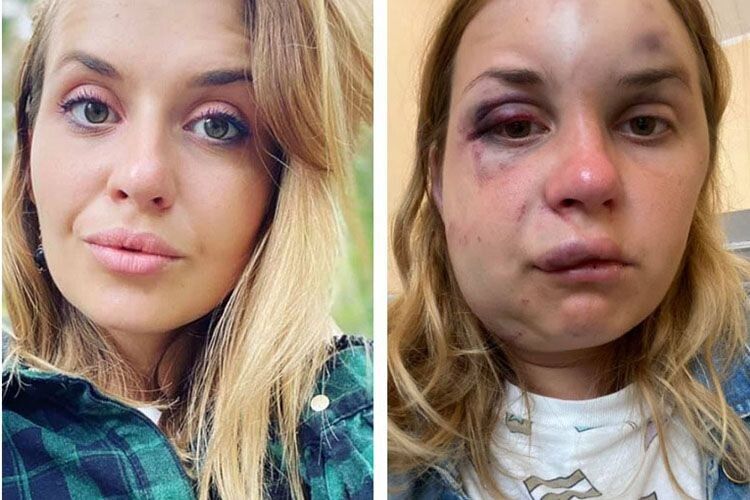 «Найстрашніше, що ніхто не зреагував»:  телеведуча дивом вижила після нападу ґвалтівника у потязі