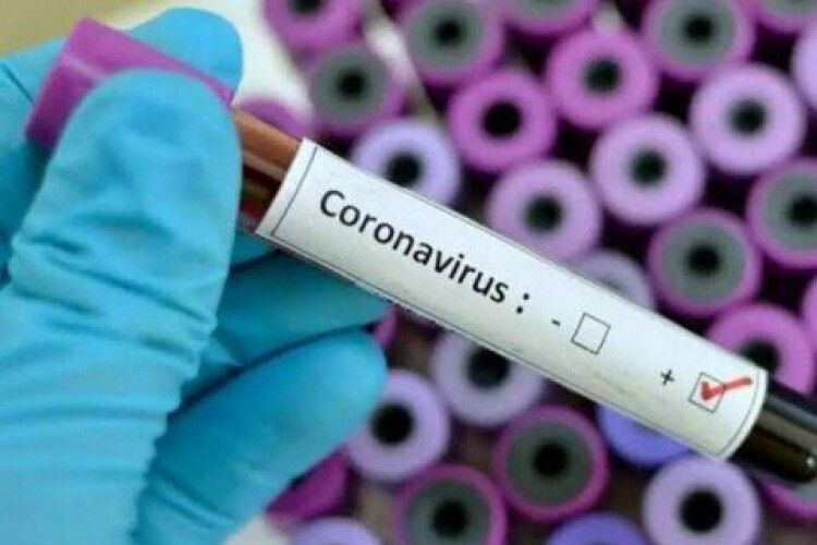 У Росії 53 пацієнти лікарні заразилися коронавірусом