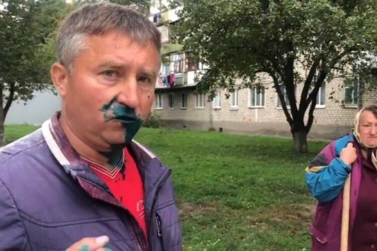 У Житомирі раптово позеленів депутат від «Опоблоку»