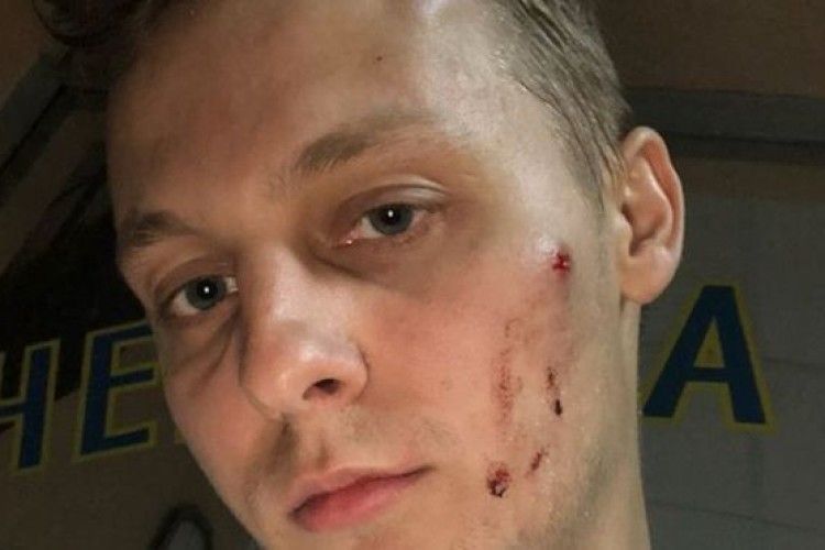 У Києві побили сина депутата Шуфрича
