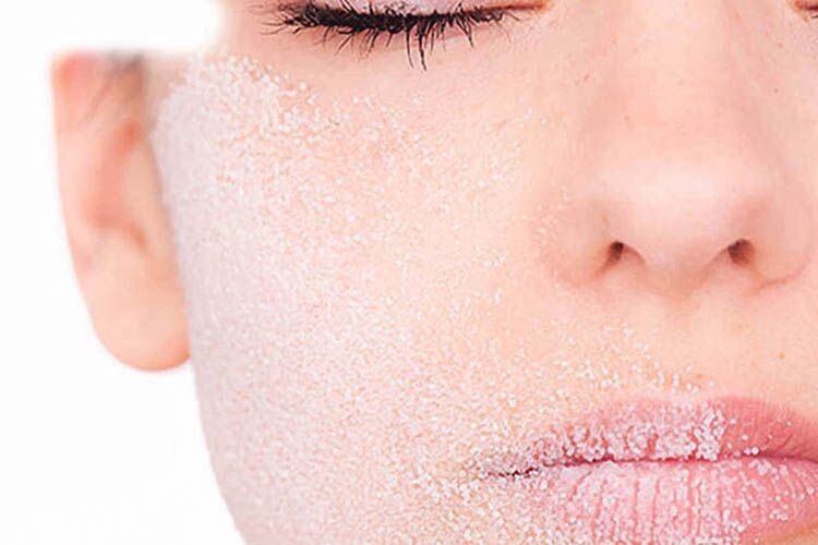 Холодної пори губи потребують особливого догляду