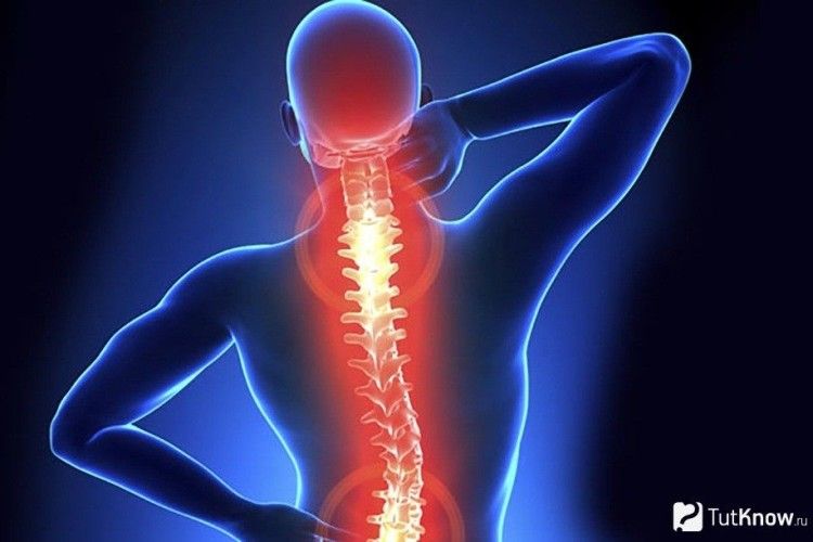 10 порад нейрохірурга,  як вберегти спину від болю