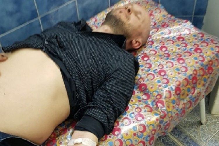 В Одесі напали на журналіста – той відстрілювався з пістолета