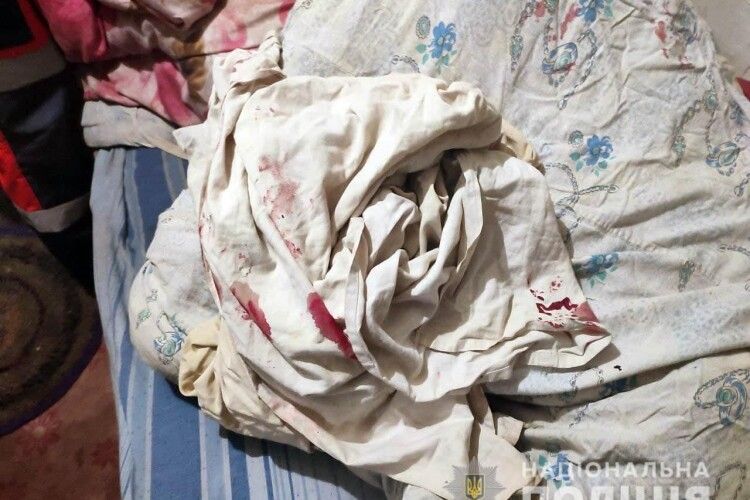 На Рівненщині чоловік побив 91-річну матір коцюбою (Фото)