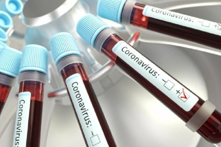 Спалах коронавірусу на Любешівщині: де виявили нових хворих