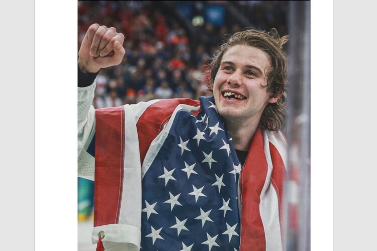 Олімпіада-2026: ціна «золота» – вибиті зуби