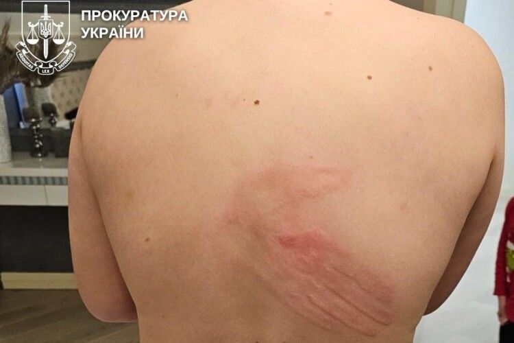 Босоніж на морозі: на Рівненщині судили батька-тирана