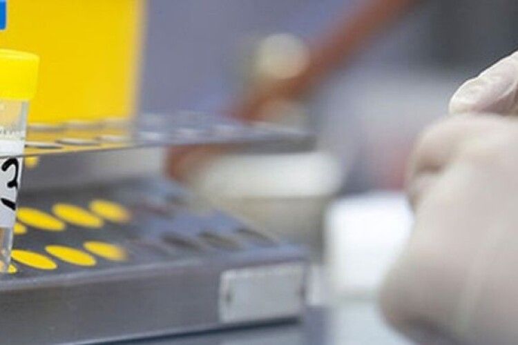 У Львові почали робити тести на імунітет до коронавірусу