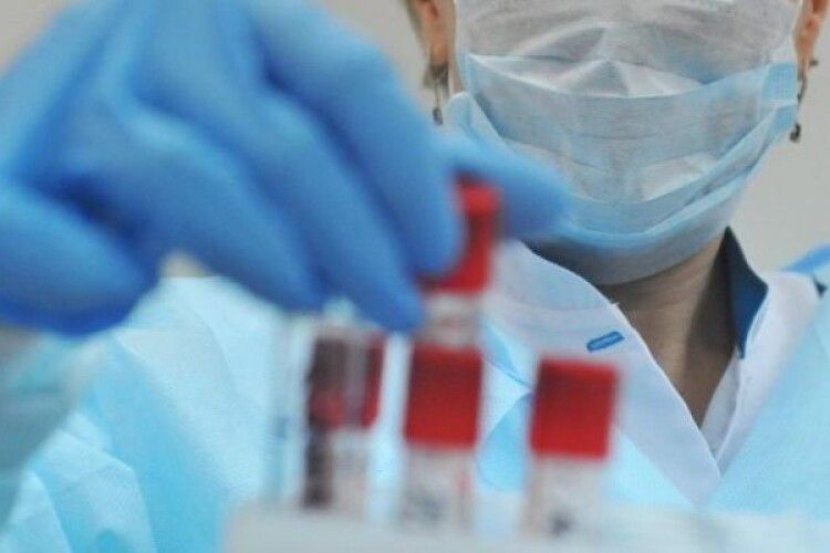 Коронавірус в Україні: 2462 нових випадки. На Волині +64 