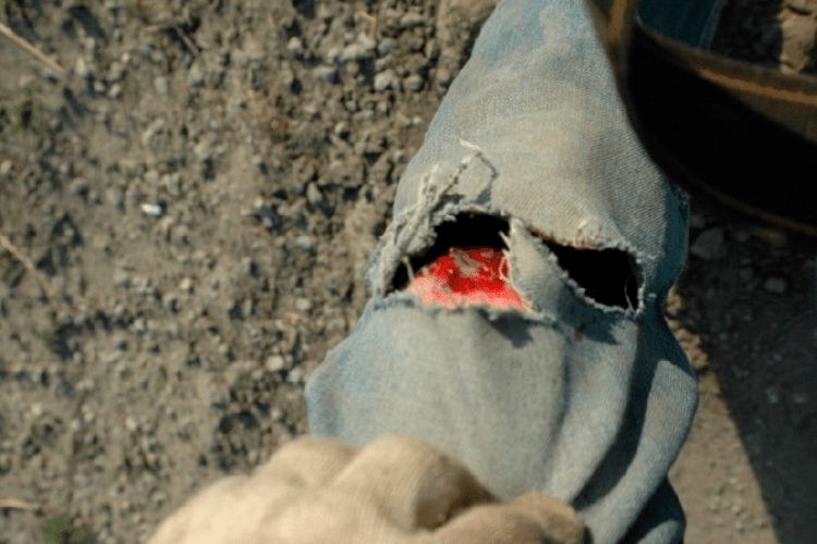 Що робити у випадку поранення (Поради фахівців)