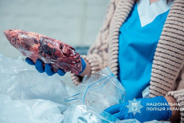 Як на Буковині лікарі заробляли на тілах померлих