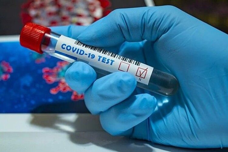 235 волинян захворіли на коронавірус учора. Померло - п’ятеро