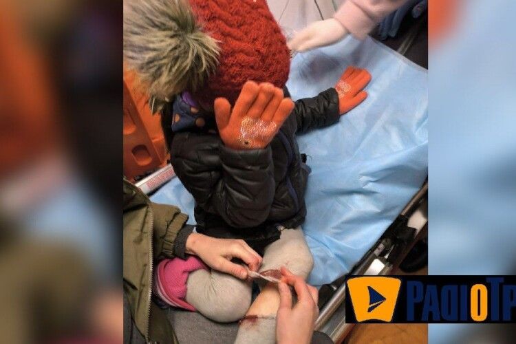 Вибух на дитмайданчику у Рівному: дівчинку виписали з лікарні, винуватця – прооперували (Відео)