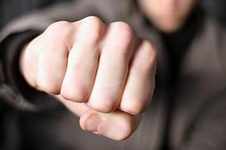 На Волині обрано запобіжний захід чоловікові, який побив знайомого так, що той помер у лікарні