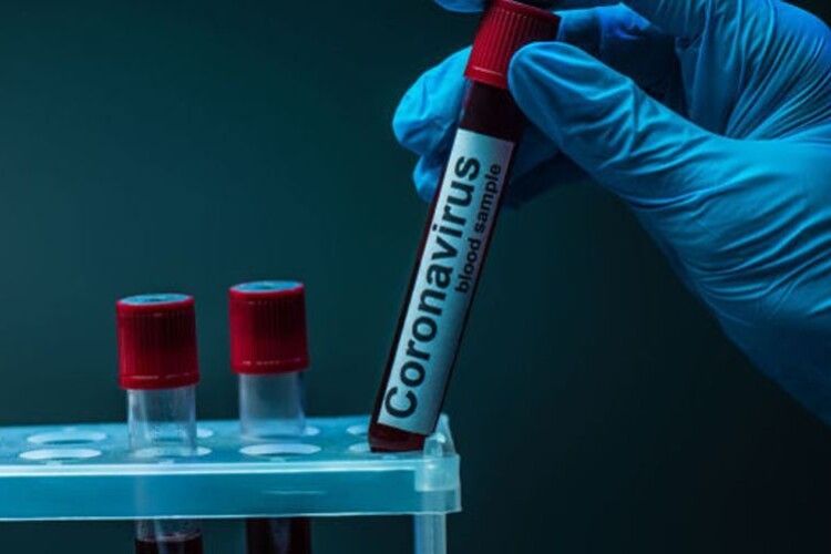 У Володимирі-Волинському кров одужалих від коронавірусу збиратимуть для лікування хворих