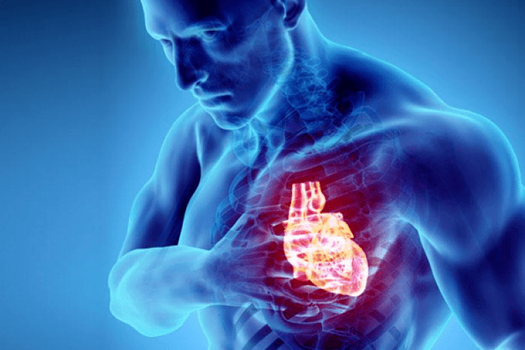 Що таке серцева недостатність та чим вона небезпечна