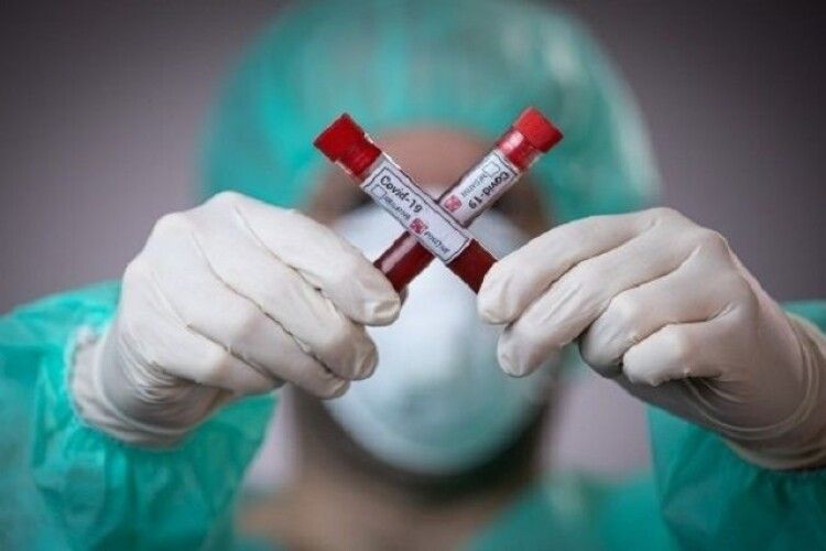 7 медиків на Рівненщині заразилися коронавірусом від жінки з переломом