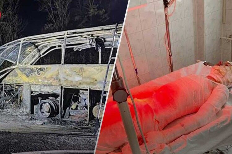 Намагався врятувати маму: 17-річний хлопець у жахливій ДТП на Рівненщині отримав 60% опіків тіла