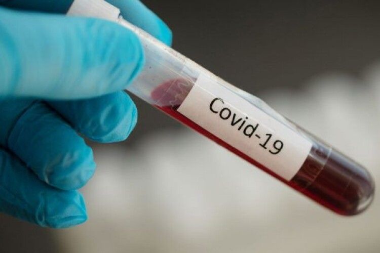 На коронавірус обстежили 8% волинян