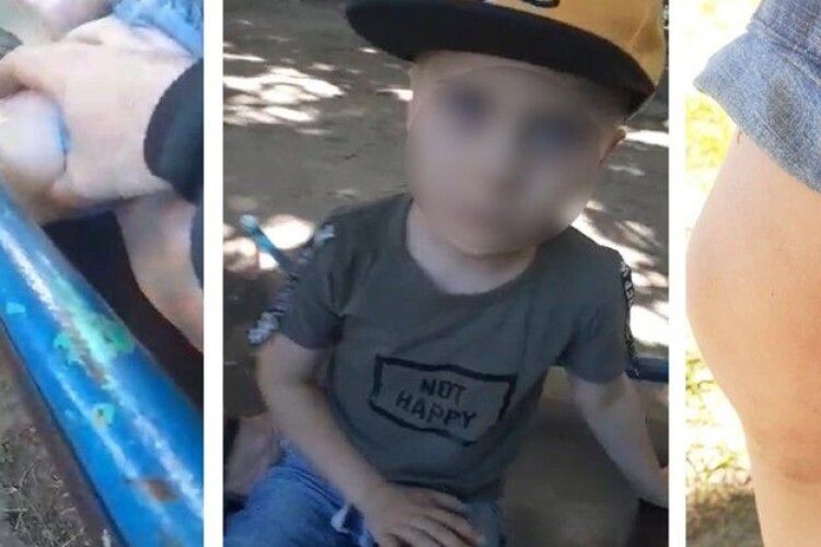 Хлопчик застряг на гірці — рятувальники скористались олією (Відео)