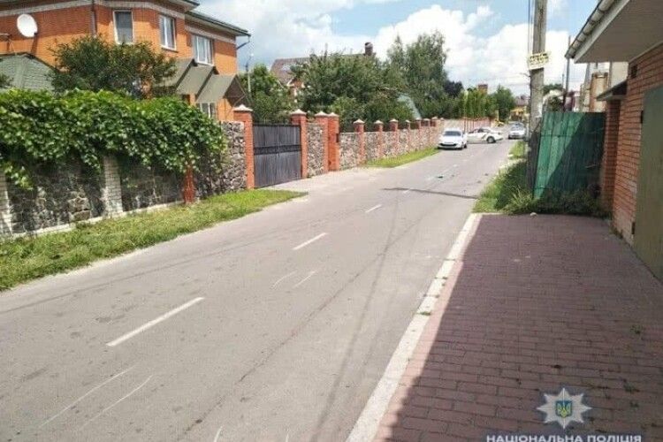 За 200 доларів чоловікові прострелили ногу та руку