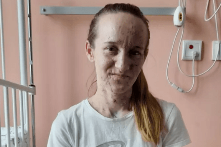 Втратили зір від поранень: мама і двоє дітей, постраждалі на Луганщині, знову можуть бачити (Фото)