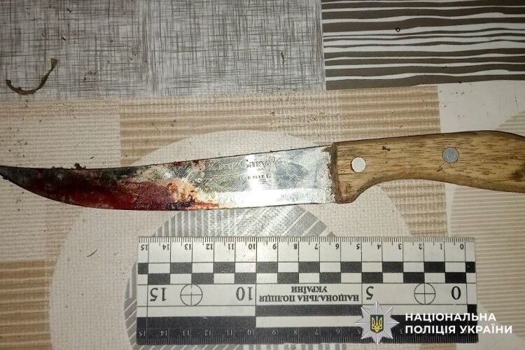 На Рівненщині чоловік відрубав знайомому пальці, підозрюючи його у крадіжці