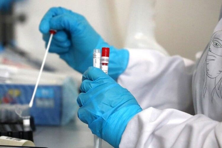У Нововолинській громаді побільшало хворих на коронавірус